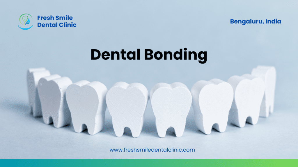 Strong Bonds, Beautiful Smiles: All You Need to Know About Dental Bonding