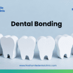 Dental Bonding