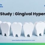 Overcoming Gingival Hyperplasia: A Multifaceted Case Study on Diagnosis, Treatment, and Long-term Management Strategies