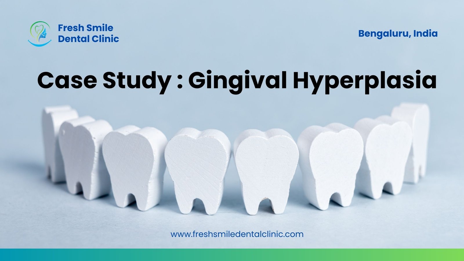 Overcoming Gingival Hyperplasia: A Multifaceted Case Study on Diagnosis, Treatment, and Long-term Management Strategies