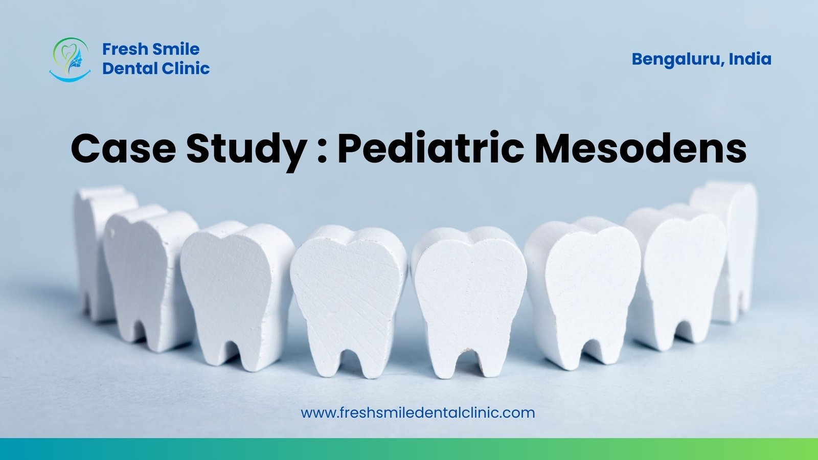 Curing Pediatric Mesodens: A Comprehensive Case Study on Diagnosis, Management, and Long-term Dental Health