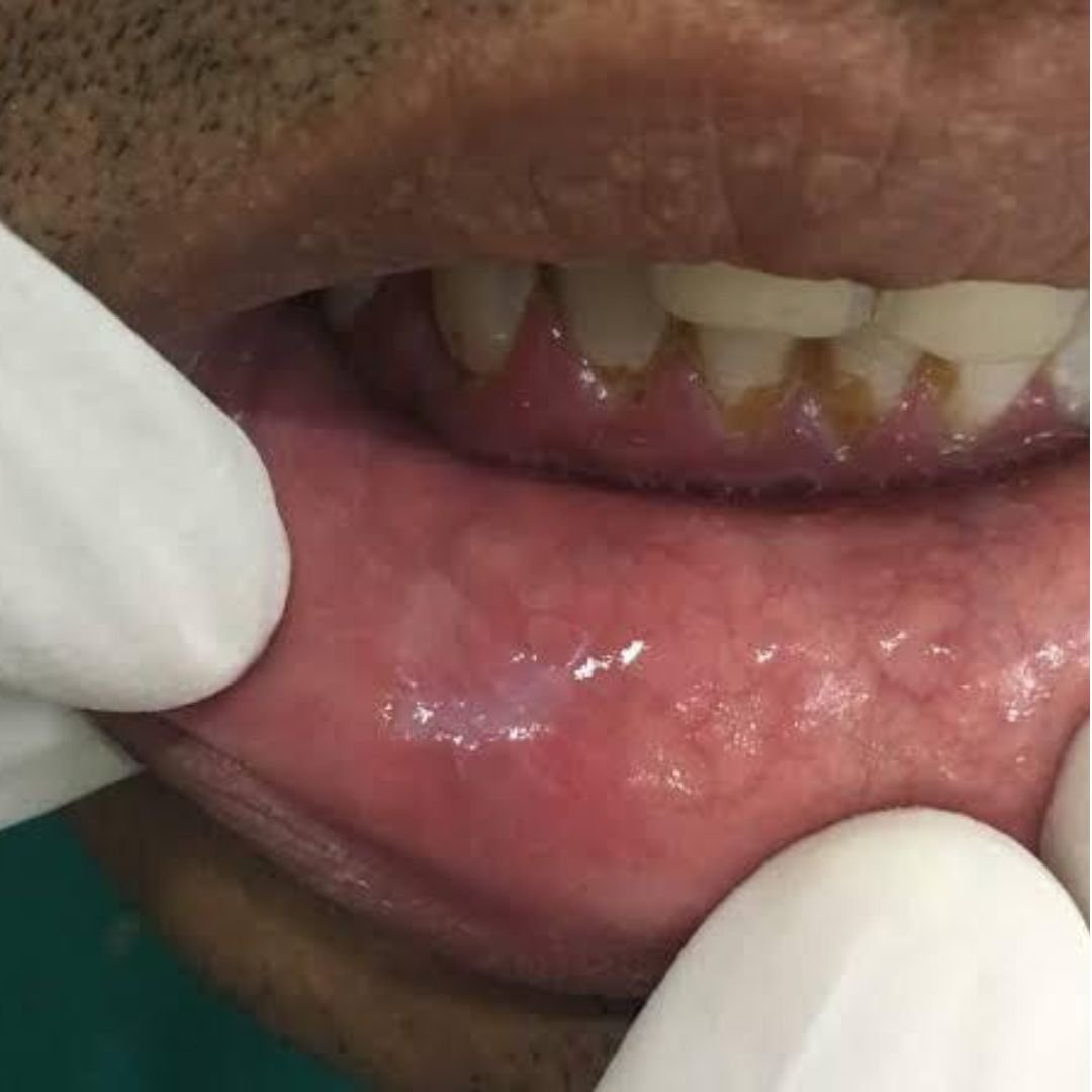 Fresh Smile Dental Clinic in Bengaluru