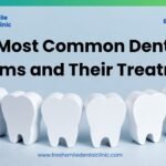 11 Most Common Dental Problems and Their Treatments