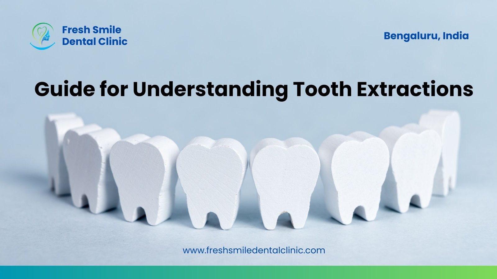 Guide for Understanding Tooth Extractions