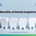 Benefits of Dental Implants