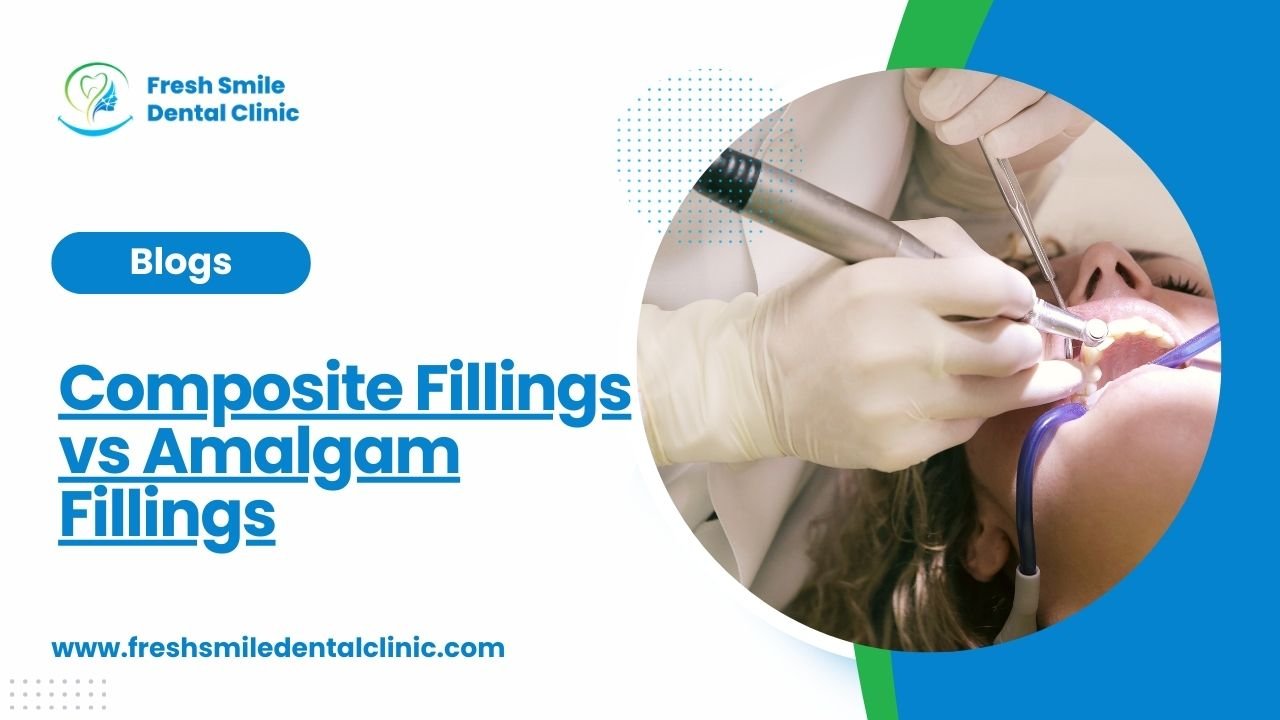 Composite Fillings vs Amalgam Fillings
