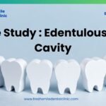 Creating Full False Teeth for an Entire Toothless Mouth: A Remarkable Dental Achievement