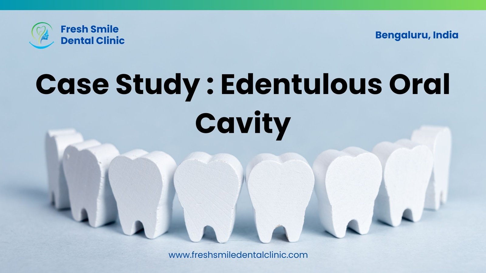 Creating Full False Teeth for an Entire Toothless Mouth: A Remarkable Dental Achievement