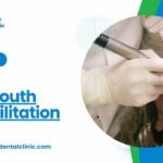 Full-Mouth Rehabilitation