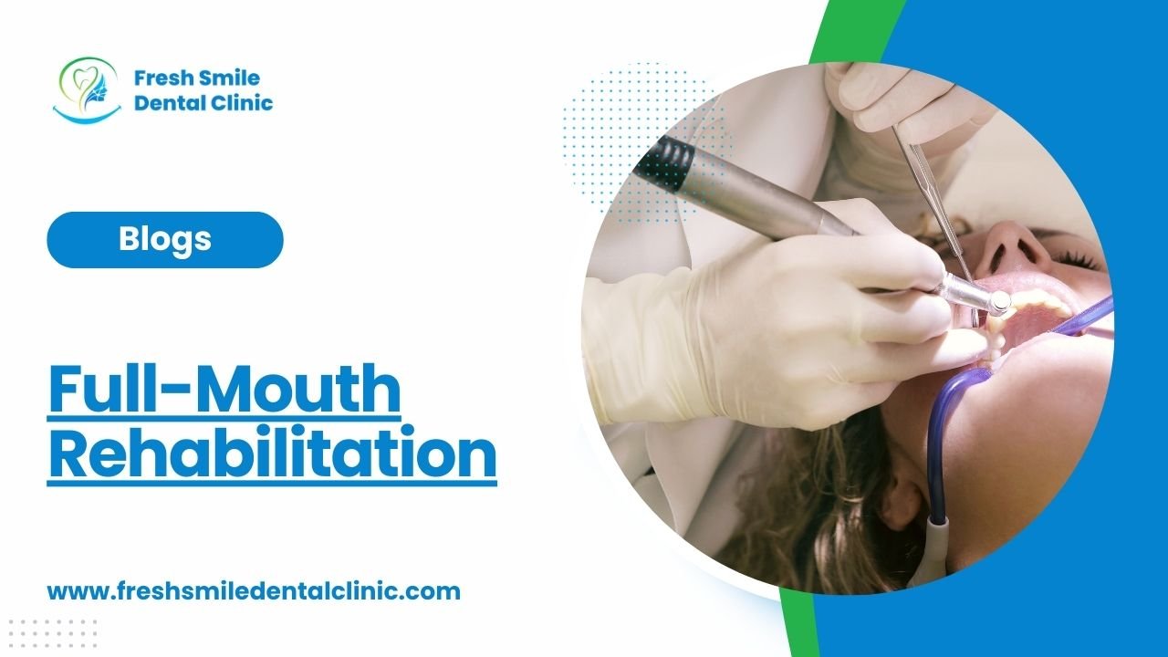 Full-Mouth Rehabilitation