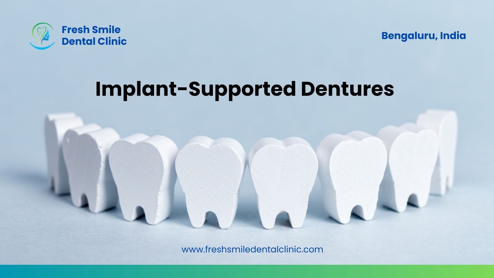Implant-Supported Dentures in Enhancing Stability and Comfort