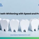 Laser Teeth Whitening with Speed and Precision