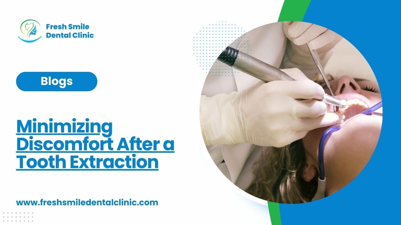 Minimizing Discomfort After a Tooth Extraction