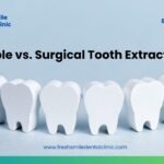 Simple vs. Surgical Tooth Extractions