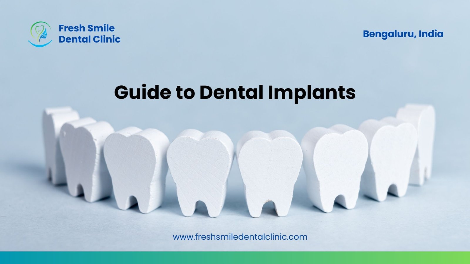 Step-by-Step Guide to Dental Implants