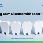 laser gum therapy